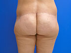 RGV Cosmetic Surgery Vein Care 