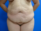 RGV Cosmetic Surgery Vein Care 