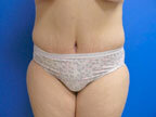 RGV Cosmetic Surgery Vein Care 