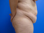 RGV Cosmetic Surgery Vein Care 