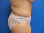 RGV Cosmetic Surgery Vein Care 