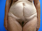 RGV Cosmetic Surgery Vein Care 
