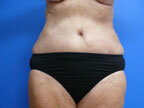 RGV Cosmetic Surgery Vein Care 