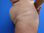 RGV Cosmetic Surgery Vein Care 