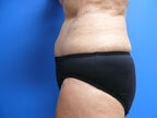 RGV Cosmetic Surgery Vein Care 