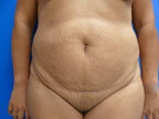 RGV Cosmetic Surgery Vein Care 