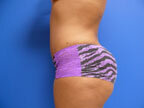 RGV Cosmetic Surgery Vein Care 