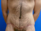 RGV Cosmetic Surgery Vein Care 