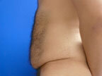 RGV Cosmetic Surgery Vein Care 