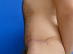 RGV Cosmetic Surgery Vein Care 