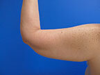 RGV Cosmetic Surgery Vein Care 