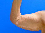 RGV Cosmetic Surgery Vein Care 