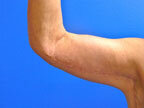 RGV Cosmetic Surgery Vein Care 