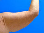 RGV Cosmetic Surgery Vein Care 