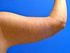 RGV Cosmetic Surgery Vein Care 