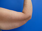 RGV Cosmetic Surgery Vein Care 