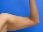 RGV Cosmetic Surgery Vein Care 