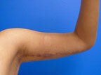 RGV Cosmetic Surgery Vein Care 