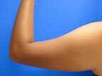 RGV Cosmetic Surgery Vein Care 