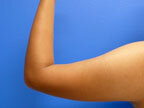 RGV Cosmetic Surgery Vein Care 