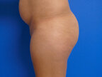 RGV Cosmetic Surgery Vein Care 