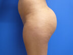RGV Cosmetic Surgery Vein Care 