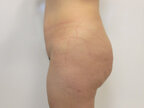 RGV Cosmetic Surgery Vein Care 