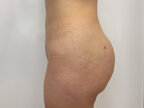 RGV Cosmetic Surgery Vein Care 