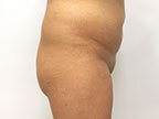 RGV Cosmetic Surgery Vein Care 
