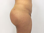 RGV Cosmetic Surgery Vein Care 