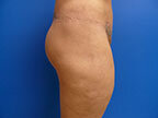 RGV Cosmetic Surgery Vein Care 