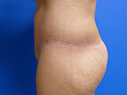 RGV Cosmetic Surgery Vein Care 