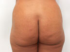 RGV Cosmetic Surgery Vein Care 