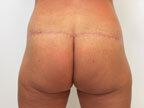 RGV Cosmetic Surgery Vein Care 