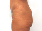 RGV Cosmetic Surgery Vein Care 