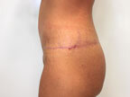 RGV Cosmetic Surgery Vein Care 