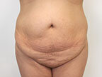 RGV Cosmetic Surgery Vein Care 