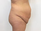 RGV Cosmetic Surgery Vein Care 