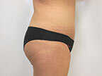 RGV Cosmetic Surgery Vein Care 