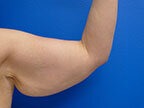 RGV Cosmetic Surgery Vein Care 