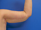 RGV Cosmetic Surgery Vein Care 