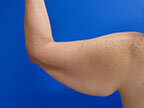 RGV Cosmetic Surgery Vein Care 