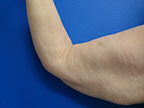 RGV Cosmetic Surgery Vein Care 