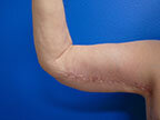 RGV Cosmetic Surgery Vein Care 