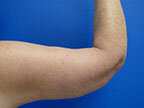 RGV Cosmetic Surgery Vein Care 