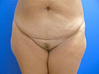 RGV Cosmetic Surgery Vein Care 