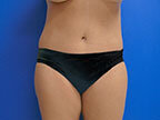 RGV Cosmetic Surgery Vein Care 
