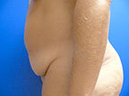 RGV Cosmetic Surgery Vein Care 