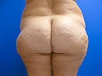 RGV Cosmetic Surgery Vein Care 