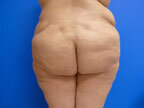 RGV Cosmetic Surgery Vein Care 